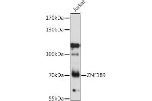 Western blot analysis of extracts of Jurkat cells, using ZNF189 antibody (ABIN7271463) at 1:1000 dilution. (ZNF189 antibody  (AA 1-150))