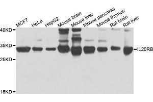 Western blot analysis of extracts of various cells, using IL20RB antibody.