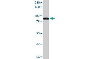 UBTF monoclonal antibody (M02), clone 6C6. (UBTF antibody  (AA 551-650))