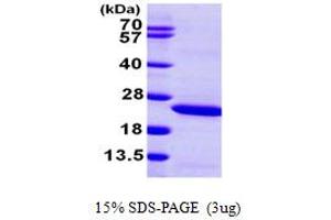SDS-PAGE (SDS) image for Lipocalin 2 (LCN2) (AA 21-198) protein (His tag) (ABIN667874) (Lipocalin 2 Protein (LCN2) (AA 21-198) (His tag))