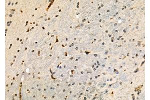 ABIN6264434 and ABIN6277935 at 1/100 staining Mouse brain tissue by IHC-P. (PRMT7 antibody  (Internal Region))