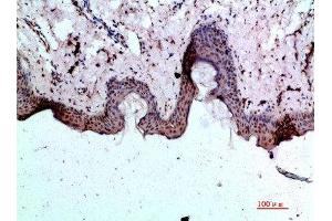 Immunohistochemical analysis of paraffin-embedded human-skin, antibody was diluted at 1:200 (BMP1 antibody  (AA 131-180))