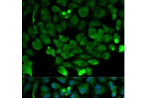 Immunofluorescence analysis of HeLa cells using CUL3 Polyclonal Antibody (Cullin 3 antibody)