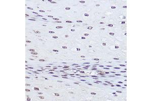 Immunohistochemistry of paraffin-embedded human esophageal using POLR2A Rabbit pAb (ABIN6130298, ABIN6145914, ABIN6145915 and ABIN6215095) at dilution of 1:50 (40x lens). (POLR2A/RPB1 antibody  (AA 1-260))