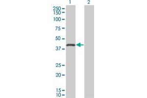 Western Blot analysis of RNF26 expression in transfected 293T cell line by RNF26 monoclonal antibody (M01), clone 5B9. (RNF26 antibody  (AA 344-433))