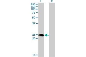 Western Blot analysis of BIN3 expression in transfected 293T cell line by BIN3 monoclonal antibody (M02A), clone 1H8. (BIN3 antibody  (AA 1-199))