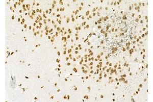 ABIN6262198 and ABIN6279481 at 1/100 staining Rat brain tissue by IHC-P. (HEATR1 antibody  (Internal Region))