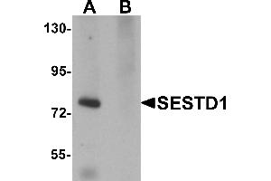 Western Blotting (WB) image for anti-SEC14 and Spectrin Domains 1 (SESTD1) (C-Term) antibody (ABIN1030653)