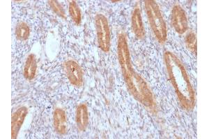 Immunohistochemistry (IHC) image for anti-Prostaglandin-Endoperoxide Synthase 2 (Prostaglandin G/H Synthase and Cyclooxygenase) (PTGS2) (AA 442-572) antibody (ABIN6940432)