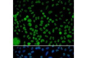 Immunofluorescence analysis of HeLa cells using IRF2 Polyclonal Antibody (IRF2 antibody)
