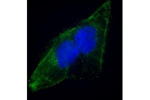Immunofluorescence (IF) image for anti-Epidermal Growth Factor Receptor Pathway Substrate 8 (EPS8) (AA 9-39), (N-Term) antibody (ABIN392773)