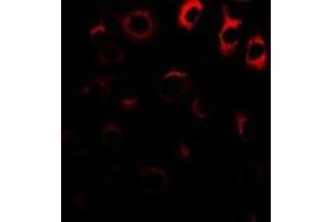 Immunofluorescent analysis of NRAGE staining in A549 cells. (MAGED1 antibody)