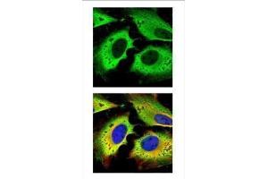 ICC/IF Image Confocal immunofluorescence analysis (Olympus FV10i) of paraformaldehyde-fixed HeLa, using GAPDH, antibody (green) at 1:500 dilution. (GAPDH antibody)