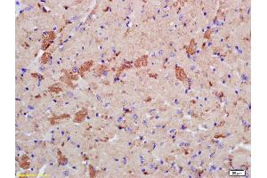 Formalin-fixed and paraffin embedded mouse heart labeled with Rabbit Anti phospho-LATS2 (Ser83) Polyclonal Antibody, Unconjugated (ABIN753568) at 1:200 followed by conjugation to the secondary antibody and DAB staining (LATS2 antibody  (pSer83))