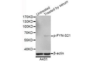Western blot analysis of extracts of A-431 cells, using Phospho-FYN-S21 antibody (ABIN5995594) at 1/1000 dilution. (FYN antibody  (pSer21))