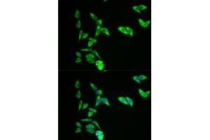 Immunofluorescence analysis of A549 cell using AK1 antibody. (Adenylate Kinase 1 antibody  (AA 1-194))