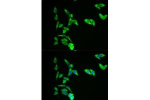 Immunofluorescence analysis of A549 cell using AK1 antibody. (Adenylate Kinase 1 antibody  (AA 1-194))
