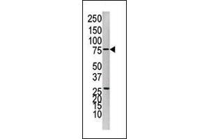 Western blot analysis of anti-PTP1B Pab (ABIN1882122 and ABIN2842257) in Jurkat cell line lysate. (PTPN1 antibody  (N-Term))