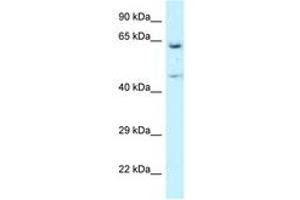 Image no. 1 for anti-Asparaginyl-tRNA Synthetase (NARS) (AA 43-92) antibody (ABIN6747536) (NARS antibody  (AA 43-92))