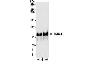 Western Blotting (WB) image for anti-CREB Regulated Transcription Coactivator 1 (CRTC1) (C-Term) antibody (ABIN7453901) (CRTC1 antibody  (C-Term))