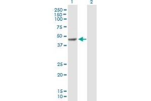 Western Blot analysis of FOXP3 expression in transfected 293T cell line by FOXP3 MaxPab polyclonal antibody. (FOXP3 antibody  (AA 1-431))