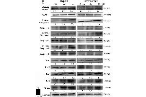 Erianin induced mitochondrial apoptosis in liver cancer cells. (BIM antibody  (AA 51-150))