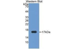 Detection of Recombinant CHEM, Human using Monoclonal Antibody to Chemerin (CHEM) (Chemerin antibody  (AA 33-158))