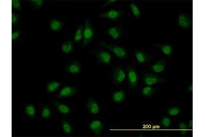 Immunofluorescence of monoclonal antibody to CLK3 on HeLa cell. (CLK3 antibody  (AA 36-136))