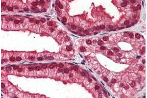 Human Prostate (formalin-fixed, paraffin-embedded) stained with NOTCH4 antibody ABIN462184 followed by biotinylated goat anti-rabbit IgG secondary antibody ABIN481713, alkaline phosphatase-streptavidin and chromogen. (NOTCH4 antibody  (AA 371-420))