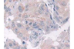 ADAMTS10 antibody  (AA 239-602)