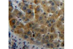 IHC-P analysis of Liver tissue, with DAB staining. (RBP1 antibody  (AA 2-135))
