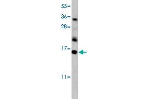 Western blot analysis of mouse kidney tissue lysate (35 ug/lane) with HRK polyclonal antibody . (HRK antibody  (AA 30-50))
