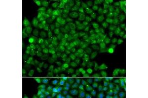Immunofluorescence analysis of A549 cells using CFHR3 Polyclonal Antibody (CFHR3 antibody)