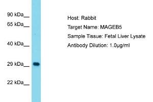 Host: Rabbit Target Name: MAGEB5 Sample Type: Fetal Liver lysates Antibody Dilution: 1. (MAGEB5 antibody  (N-Term))