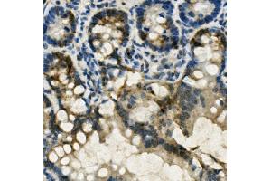 IHC analysis of FABP6 using anti-FABP6 antibody (ABIN7598974).