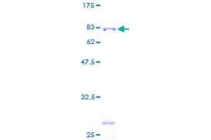 TRIM21 Protein (AA 1-475) (GST tag)