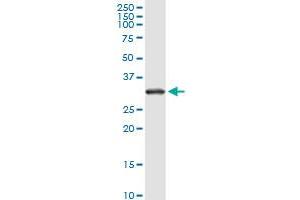 RPS2 monoclonal antibody (M01), clone 3G6. (RPS2 antibody  (AA 198-293))