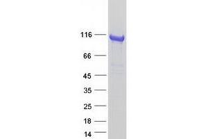 AP2B1 Protein (Transcript Variant 2) (Myc-DYKDDDDK Tag)
