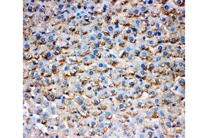IHC-P testing of rat liver tissue (HSD17B1 antibody  (AA 29-43))