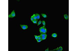 Immunofluorescent analysis of PC-3 cells using ABIN7166896 at dilution of 1:100 and Alexa Fluor 488-congugated AffiniPure Goat Anti-Rabbit IgG(H+L) (PDHA1 antibody  (AA 223-390))