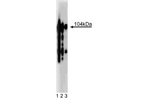 Western blot analysis of Intergrin beta3 on a human platelet lysate. (Integrin beta 3 antibody  (AA 592-712))