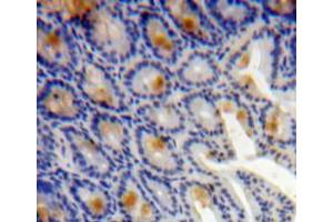 Used in DAB staining on fromalin fixed paraffin-embedded bowels tissue (TMSB4X antibody  (AA 1-44))