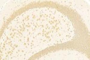 Immunohistochemistry analysis of paraffin-embedded mouse hippocampus using PPP2R2A (ABIN7075274) at dilution of 1: 2000 (PPP2R2A antibody)