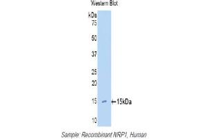 Western blot analysis of the recombinant protein. (Neuropilin 1 antibody  (AA 27-143))
