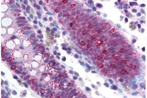 Human Colon (formalin-fixed, paraffin-embedded) stained with SF1 antibody ABIN214143 at 5 ug/ml followed by biotinylated goat anti-rabbit IgG secondary antibody ABIN481713, alkaline phosphatase-streptavidin and chromogen. (Splicing Factor 1 antibody  (AA 517-566))