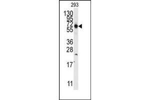 Image no. 1 for anti-Thyroid Hormone Receptor Interactor 13 (TRIP13) (N-Term) antibody (ABIN358019) (TRIP13 antibody  (N-Term))