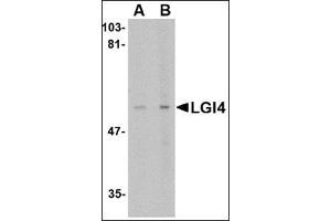 Western blot analysis of LGI4 in rat brain tissue lysate with this product at (A) 1 and (B) 2 μg/ml. (LGI4 antibody  (C-Term))