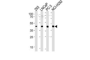 Western Blotting (WB) image for anti-Steroid 5 alpha-Reductase 3 (SRD5A3) antibody (ABIN3002292)