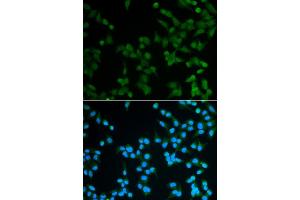 Immunofluorescence analysis of A549 cell using SPIN1 antibody. (Spindlin 1 antibody)
