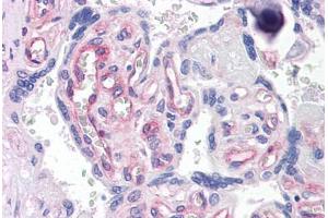 Immunohistochemistry (Formalin-fixed Paraffin-embedded Sections) (IHC (fp)) image for anti-Annexin A4 (ANXA4) (AA 1-322) antibody (ABIN574204)